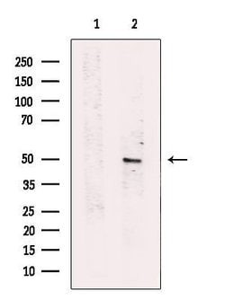 Invitrogen SERPINA11 Polyclonal Antibody 100 μL; Unconjugated:Antibodies,