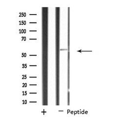 Invitrogen SCK Polyclonal Antibody 100 &mu;L; Unconjugated:Antibodies,