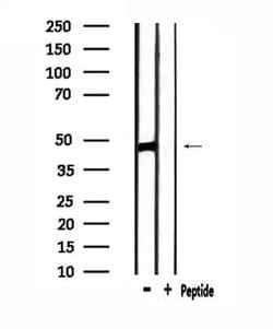 Invitrogen SIRPB1 Polyclonal Antibody 100 &mu;L; Unconjugated:Antibodies,