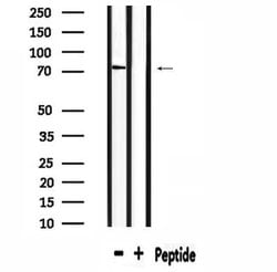 Invitrogen SLC6A8 Polyclonal Antibody 100 &mu;L | Buy Online | Invitrogen&trade; | Fisher Scientific