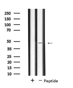 Invitrogen SLC17A2 Polyclonal Antibody 100 &mu;L; Unconjugated:Antibodies,
