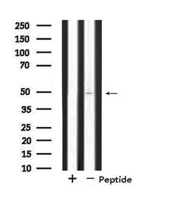 Invitrogen SYT11 Polyclonal Antibody 100 &mu;L; Unconjugated:Antibodies,