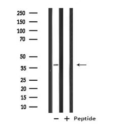 Invitrogen GTF3A Polyclonal Antibody 100 &mu;L; Unconjugated:Antibodies,
