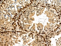 Invitrogen USP30 Polyclonal Antibody 100 &mu;L; Unconjugated:Antibodies,