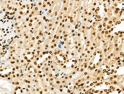 Invitrogen USP30 Polyclonal Antibody 100 &mu;L; Unconjugated:Antibodies,