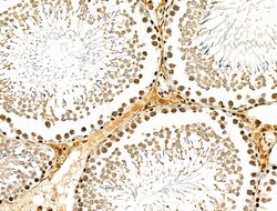 Invitrogen USP30 Polyclonal Antibody 100 &mu;L; Unconjugated:Antibodies,