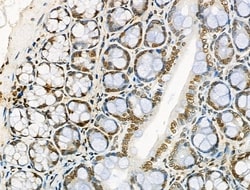 Invitrogen UBAP2L Polyclonal Antibody 100 &mu;L; Unconjugated:Antibodies,