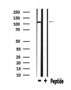 Invitrogen UBAP2L Polyclonal Antibody 100 &mu;L; Unconjugated:Antibodies,