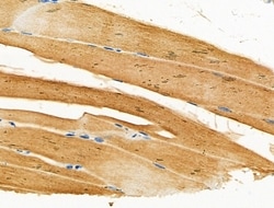 Invitrogen CACNG1 Polyclonal Antibody 100 &mu;L; Unconjugated:Antibodies,