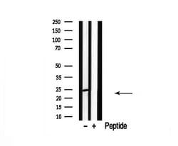 Invitrogen CACNG1 Polyclonal Antibody 100 &mu;L; Unconjugated:Antibodies,