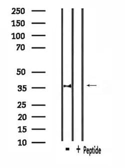 Invitrogen CACNG7 Polyclonal Antibody 100 &mu;L; Unconjugated:Antibodies,