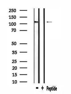 Invitrogen CACNA2D4 Polyclonal Antibody 100 &mu;L | Buy Online | Invitrogen&trade; | Fisher Scientific