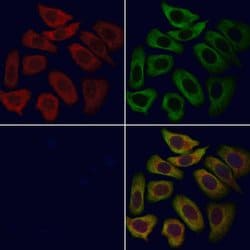 Invitrogen CaV3.2 Polyclonal Antibody 100 &mu;L; Unconjugated:Antibodies,