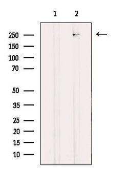 Invitrogen CaV3.2 Polyclonal Antibody 100 &mu;L; Unconjugated:Antibodies,