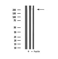 Invitrogen CaV3.2 Polyclonal Antibody 100 &mu;L; Unconjugated:Antibodies,