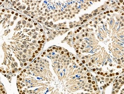 Invitrogen WEE2 Polyclonal Antibody 100 &mu;L | Buy Online | Invitrogen&trade; | Fisher Scientific