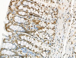 Invitrogen WEE2 Polyclonal Antibody 100 &mu;L | Buy Online | Invitrogen&trade; | Fisher Scientific