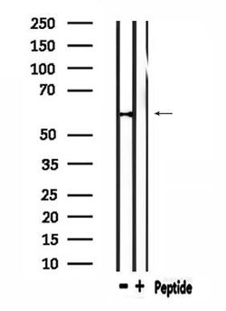 Invitrogen WEE2 Polyclonal Antibody 100 &mu;L | Buy Online | Invitrogen&trade; | Fisher Scientific