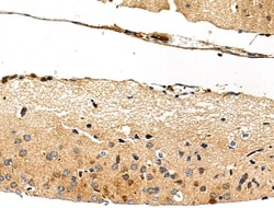 Invitrogen WASF3 Polyclonal Antibody 100 μL; Unconjugated:Antibodies,