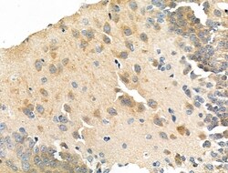 Invitrogen WASF3 Polyclonal Antibody 100 μL; Unconjugated:Antibodies,