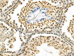 Invitrogen ZNF50 Polyclonal Antibody 100 &mu;L; Unconjugated:Antibodies,