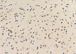 Invitrogen ZNF292 Polyclonal Antibody 100 &mu;L; Unconjugated:Antibodies,