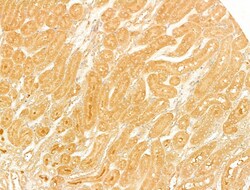 Invitrogen SLC30A4 Polyclonal Antibody 100 &mu;L; Unconjugated:Antibodies,