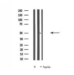 Invitrogen SLC30A4 Polyclonal Antibody 100 &mu;L; Unconjugated:Antibodies,