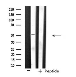 Invitrogen SLC39A7 Polyclonal Antibody 100 μL; Unconjugated:Antibodies,