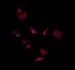 Invitrogen ZADH2 Polyclonal Antibody 100 &mu;L; Unconjugated:Antibodies,