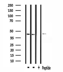 Invitrogen ZADH2 Polyclonal Antibody 100 &mu;L; Unconjugated:Antibodies,