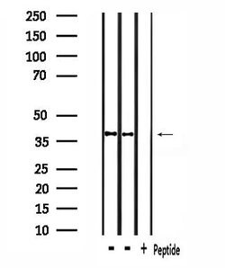 Invitrogen RNF130 Polyclonal Antibody 100 &mu;L; Unconjugated:Antibodies,