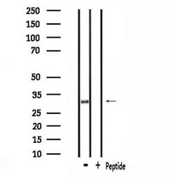 Invitrogen SMUG1 Polyclonal Antibody 100 &mu;L; Unconjugated:Antibodies,