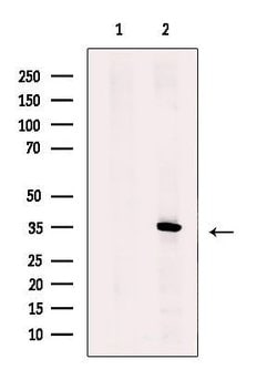 Invitrogen ZNF691 Polyclonal Antibody 100 &mu;L | Buy Online | Invitrogen&trade; | Fisher Scientific