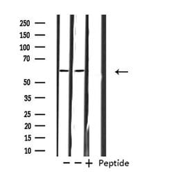 Invitrogen ZNF695 Polyclonal Antibody 100 &mu;L; Unconjugated:Antibodies,