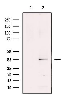 Invitrogen RNF113B Polyclonal Antibody 100 &mu;L; Unconjugated:Antibodies,
