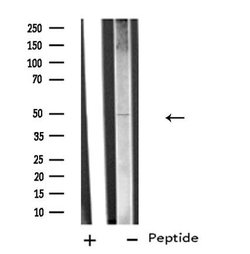 Invitrogen SLC38A2 Polyclonal Antibody 100 &mu;L; Unconjugated:Antibodies,