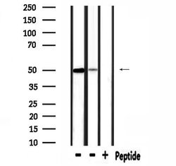Invitrogen SLC38A2 Polyclonal Antibody 100 &mu;L; Unconjugated:Antibodies,