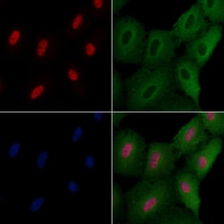 Invitrogen ELF4 Polyclonal Antibody 100 &mu;L; Unconjugated:Antibodies,