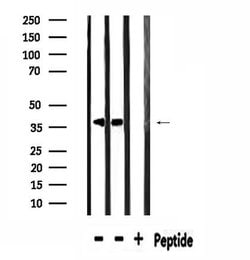 Invitrogen SPON2 Polyclonal Antibody 100 &mu;L; Unconjugated:Antibodies,