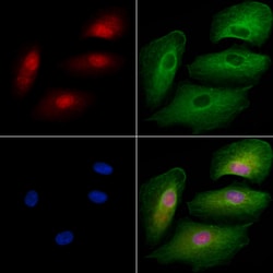 Invitrogen ZNF446 Polyclonal Antibody 100 &mu;L; Unconjugated:Antibodies,