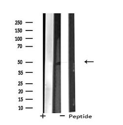 Invitrogen ZNF446 Polyclonal Antibody 100 &mu;L; Unconjugated:Antibodies,
