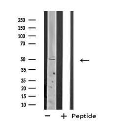 Invitrogen PLAGL1 Polyclonal Antibody 100 &mu;L; Unconjugated:Antibodies,