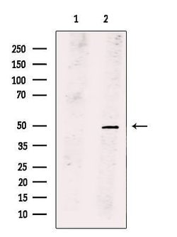 Invitrogen PLAGL1 Polyclonal Antibody 100 &mu;L; Unconjugated:Antibodies,