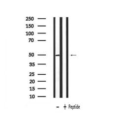 Invitrogen PLAGL1 Polyclonal Antibody 100 &mu;L; Unconjugated:Antibodies,