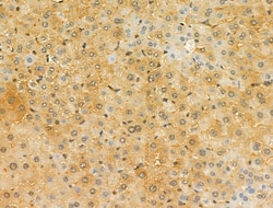 Invitrogen STARD10 Polyclonal Antibody 100 μL; Unconjugated:Antibodies,