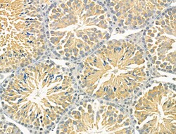 Invitrogen STARD10 Polyclonal Antibody 100 μL; Unconjugated:Antibodies,