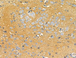 Invitrogen STARD10 Polyclonal Antibody 100 μL; Unconjugated:Antibodies,