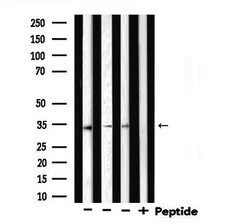 Invitrogen STARD10 Polyclonal Antibody 100 μL; Unconjugated:Antibodies,