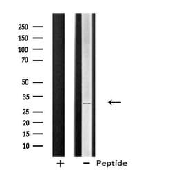 Invitrogen STARD10 Polyclonal Antibody 100 μL; Unconjugated:Antibodies,
